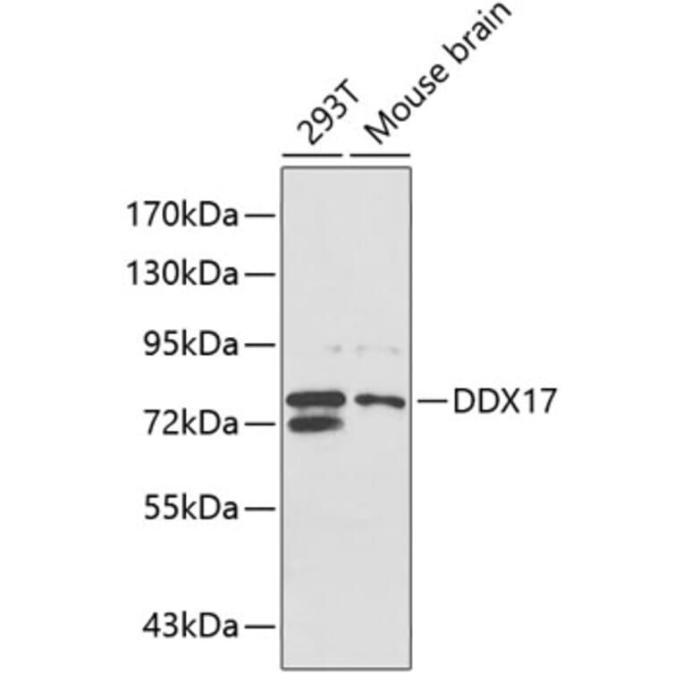 Western Blot - Anti-DDX17 Antibody (A5957) - Antibodies.com