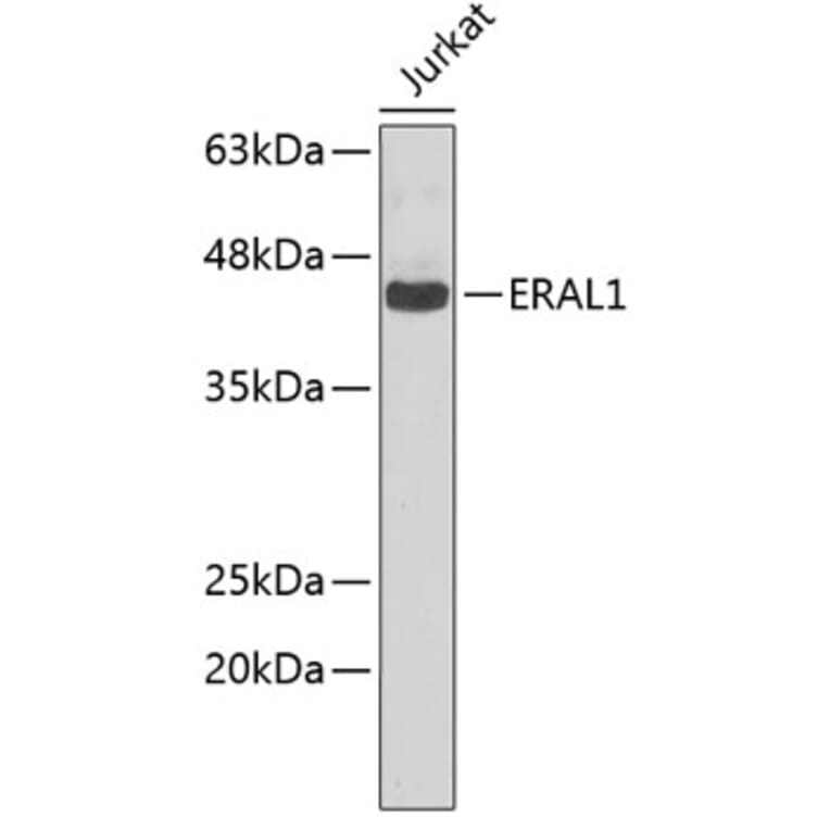 Western Blot - Anti-ERAL1 Antibody (A5974) - Antibodies.com