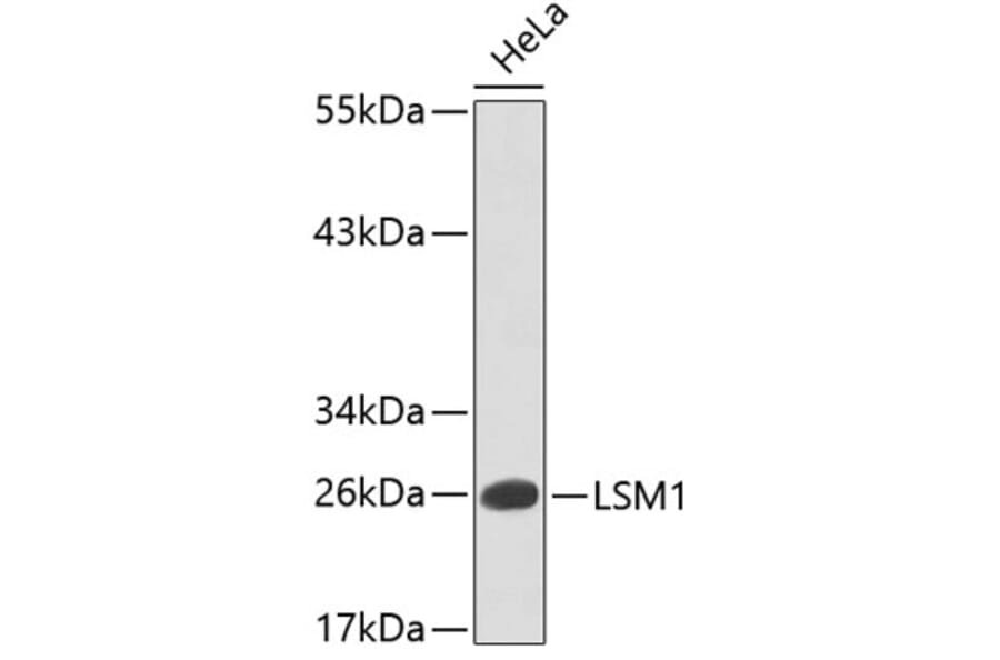 Western Blot - Anti-LSM1 Antibody (A5976) - Antibodies.com