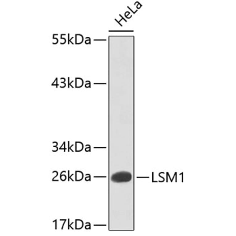 Western Blot - Anti-LSM1 Antibody (A5976) - Antibodies.com