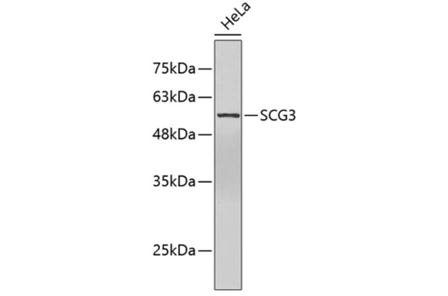 Western Blot - Anti-SCG3 Antibody (A5980) - Antibodies.com