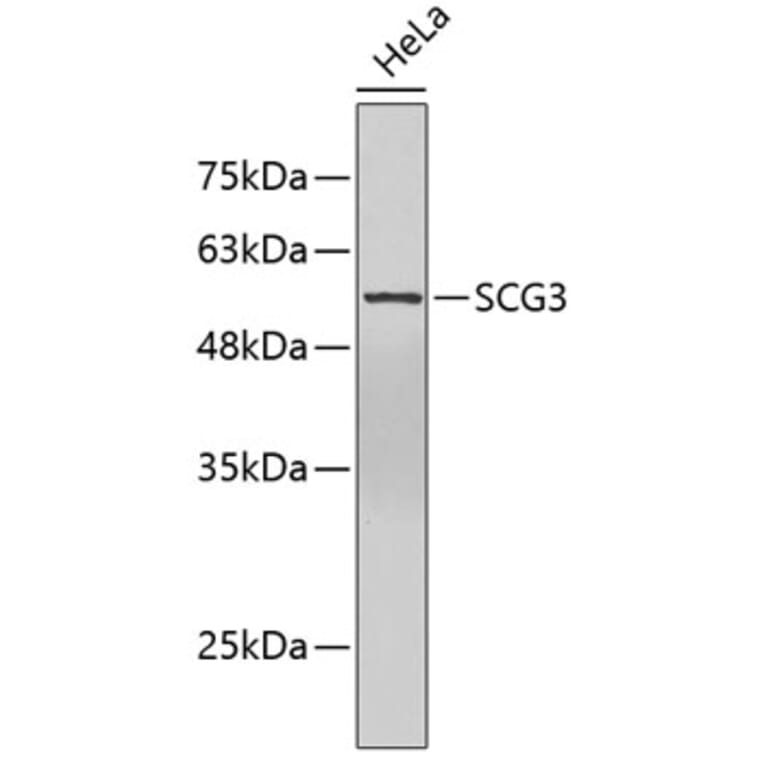 Western Blot - Anti-SCG3 Antibody (A5980) - Antibodies.com