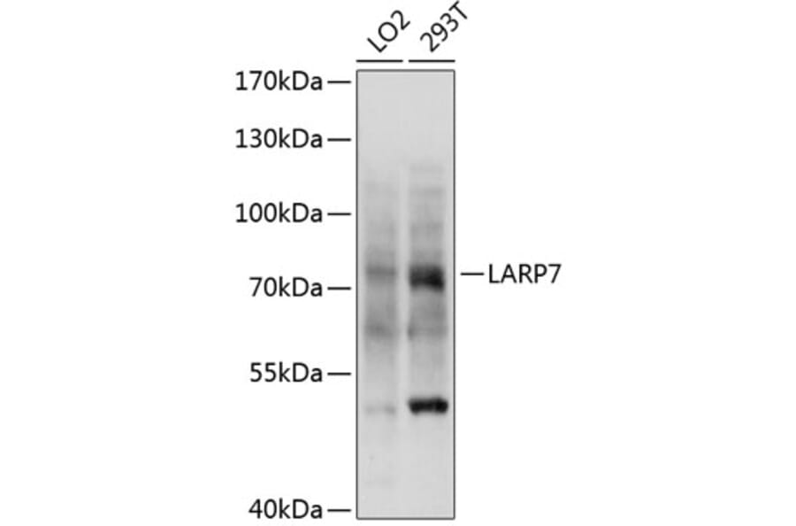 Western Blot - Anti-LARP7 Antibody (A5983) - Antibodies.com