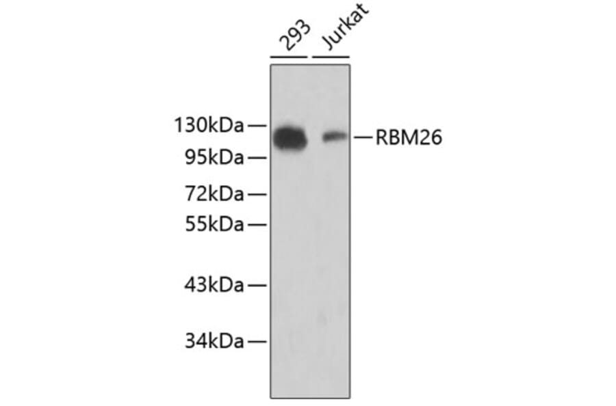 Western Blot - Anti-RBM26 Antibody (A5997) - Antibodies.com