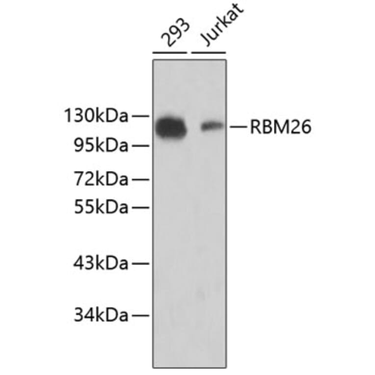 Western Blot - Anti-RBM26 Antibody (A5997) - Antibodies.com