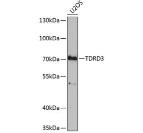 Western Blot - Anti-TDRD3 Antibody (A9781) - Antibodies.com