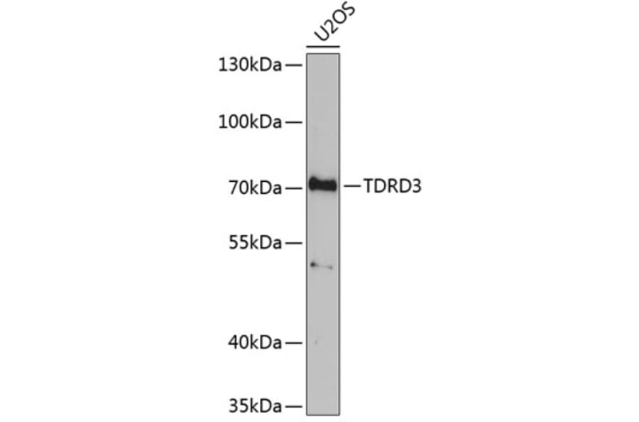 Western Blot - Anti-TDRD3 Antibody (A9781) - Antibodies.com