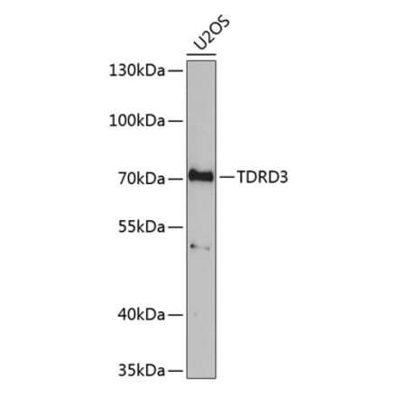 Western Blot - Anti-TDRD3 Antibody (A9781) - Antibodies.com
