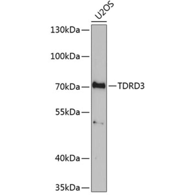 Western Blot - Anti-TDRD3 Antibody (A9781) - Antibodies.com