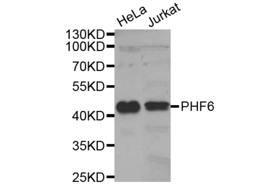 Western Blot - Anti-PHF6 Antibody (A6003) - Antibodies.com