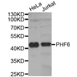 Western Blot - Anti-PHF6 Antibody (A6003) - Antibodies.com