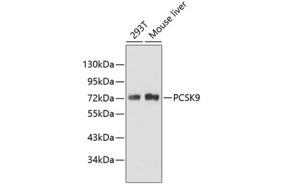 Western Blot - Anti-PCSK9 Antibody (A6006) - Antibodies.com