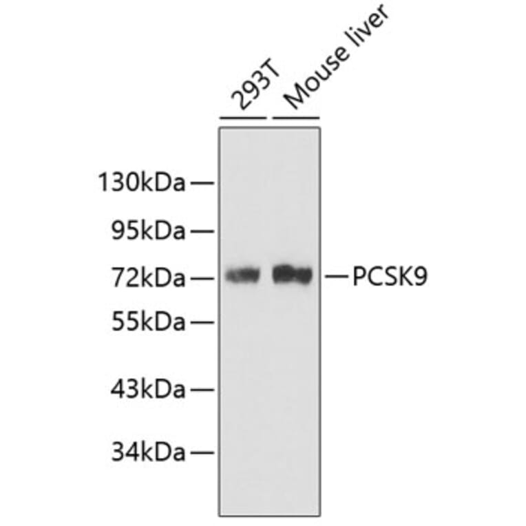 Western Blot - Anti-PCSK9 Antibody (A6006) - Antibodies.com