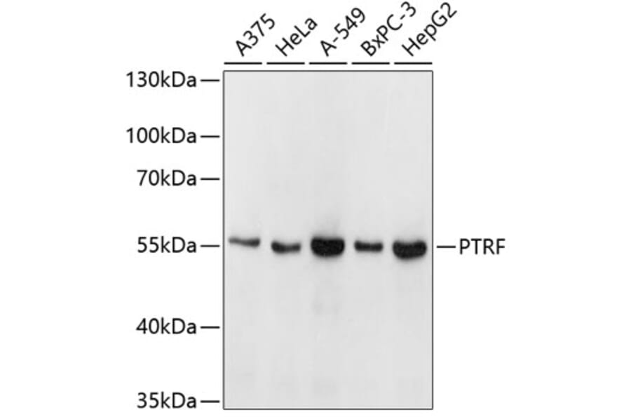 Western Blot - Anti-PTRF Antibody (A6007) - Antibodies.com
