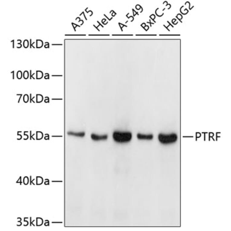 Western Blot - Anti-PTRF Antibody (A6007) - Antibodies.com