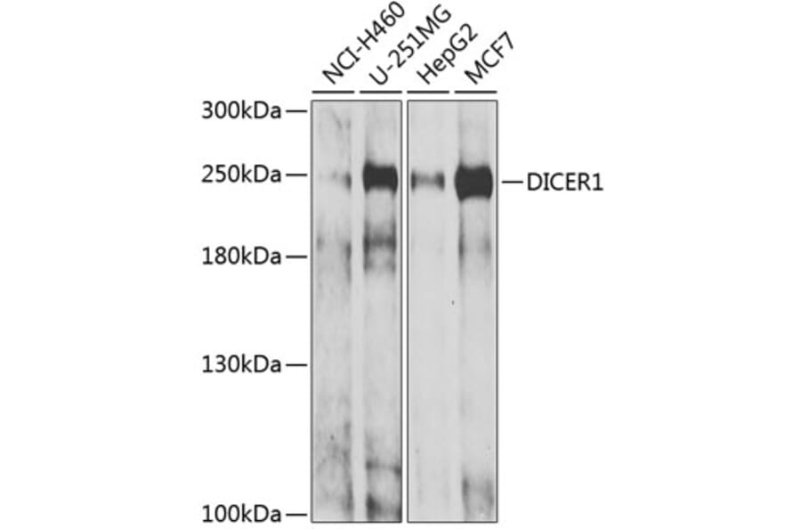Western Blot - Anti-DICER1 Antibody (A6021) - Antibodies.com