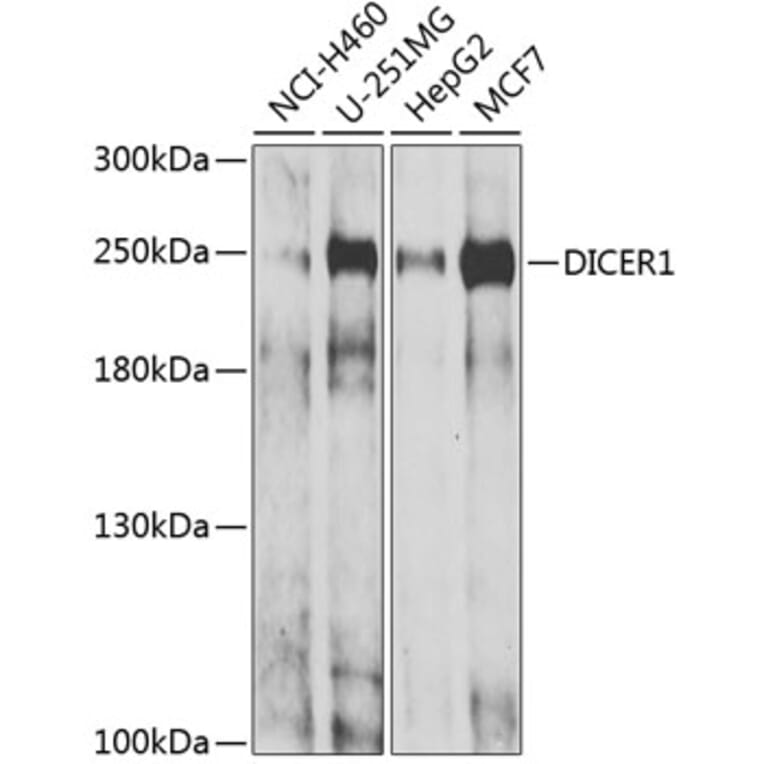 Western Blot - Anti-DICER1 Antibody (A6021) - Antibodies.com