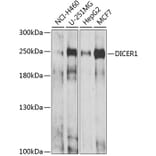 Western Blot - Anti-DICER1 Antibody (A6021) - Antibodies.com