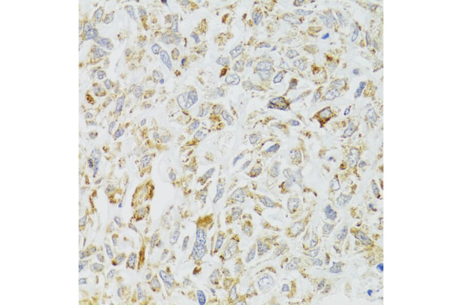 Immunohistochemistry - Anti-DICER1 Antibody (A6021) - Antibodies.com