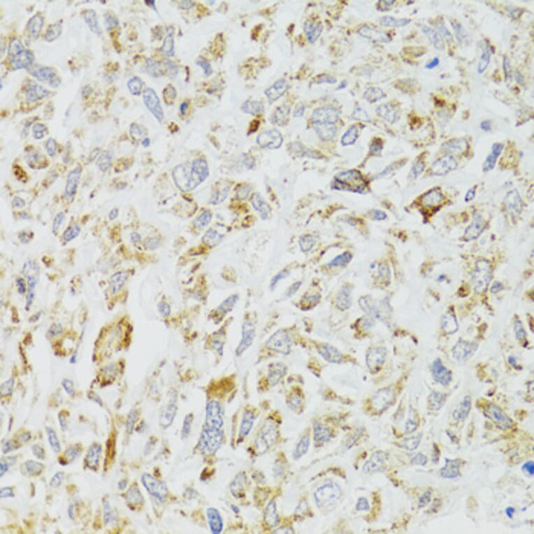 Immunohistochemistry - Anti-DICER1 Antibody (A6021) - Antibodies.com