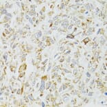 Immunohistochemistry - Anti-DICER1 Antibody (A6021) - Antibodies.com