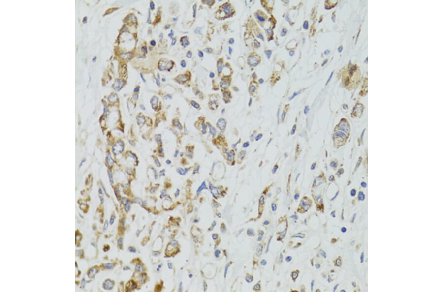 Immunohistochemistry - Anti-DICER1 Antibody (A6021) - Antibodies.com