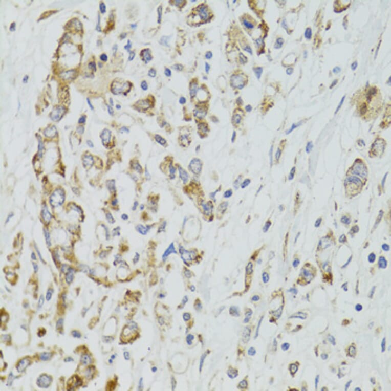Immunohistochemistry - Anti-DICER1 Antibody (A6021) - Antibodies.com