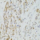 Immunohistochemistry - Anti-DICER1 Antibody (A6021) - Antibodies.com