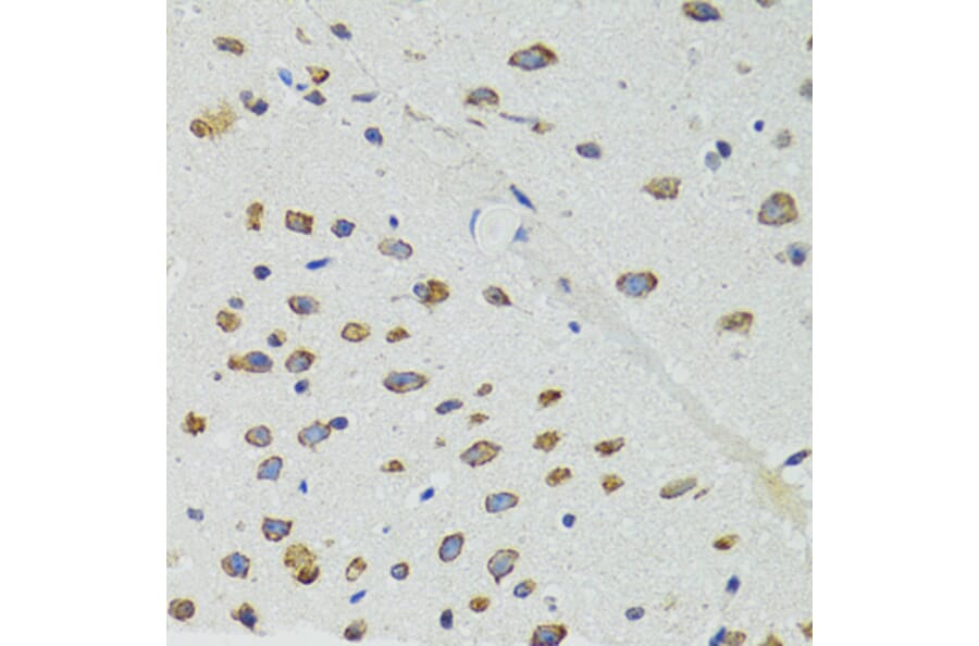 Immunohistochemistry - Anti-DICER1 Antibody (A6021) - Antibodies.com