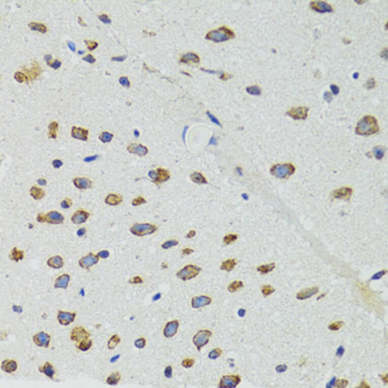 Immunohistochemistry - Anti-DICER1 Antibody (A6021) - Antibodies.com