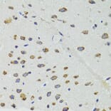Immunohistochemistry - Anti-DICER1 Antibody (A6021) - Antibodies.com