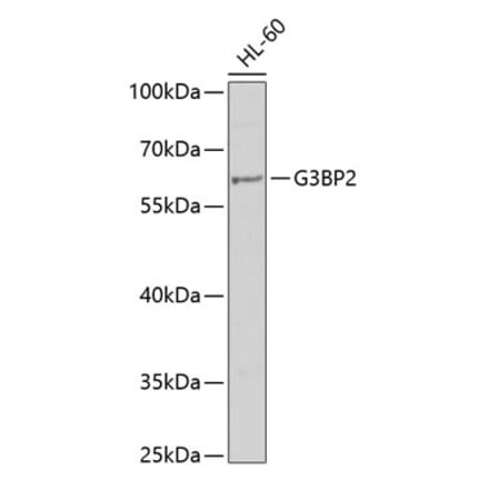 Western Blot - Anti-G3BP2 Antibody (A9787) - Antibodies.com