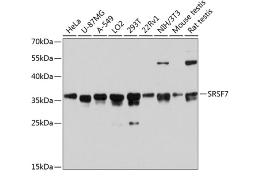 Western Blot - Anti-SRSF7 Antibody (A6069) - Antibodies.com