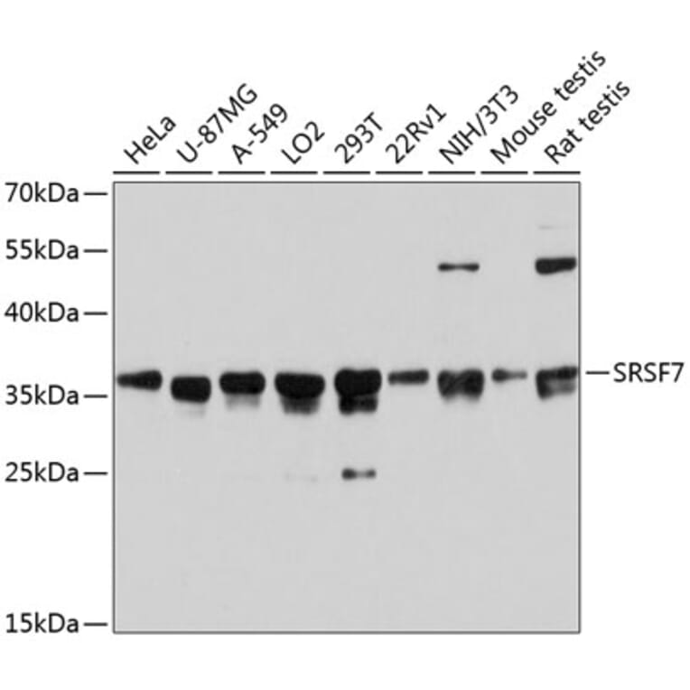 Western Blot - Anti-SRSF7 Antibody (A6069) - Antibodies.com