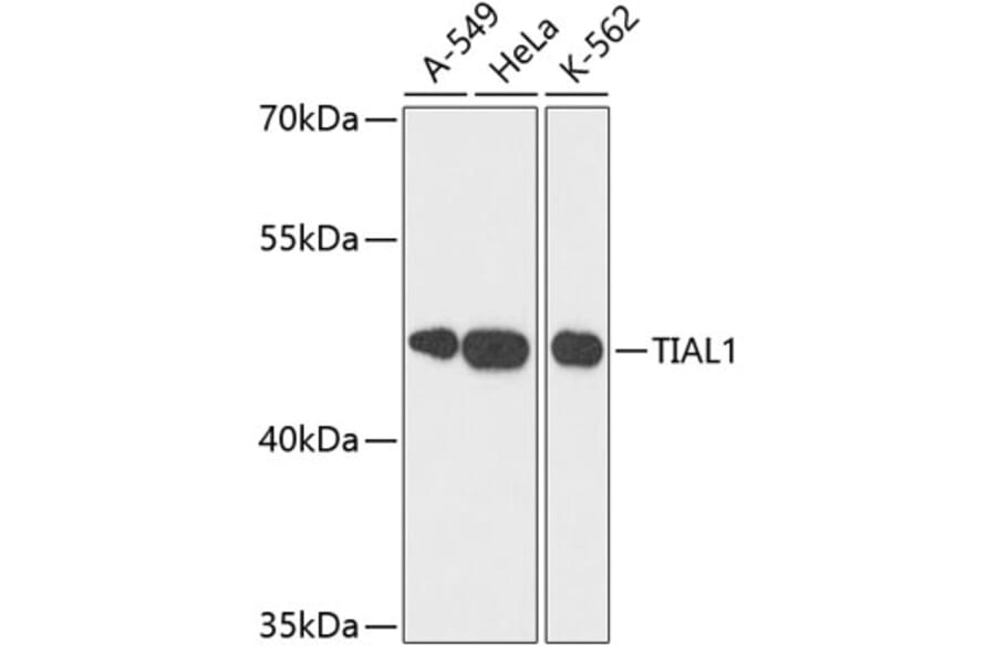 Western Blot - Anti-TIAL1 Antibody (A9790) - Antibodies.com