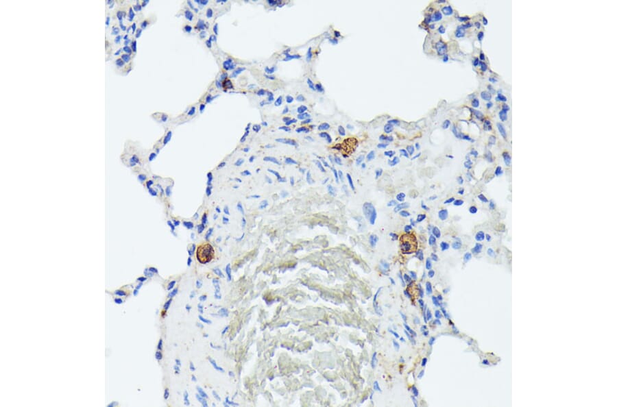 Immunohistochemistry - Anti-TIAL1 Antibody (A9790) - Antibodies.com