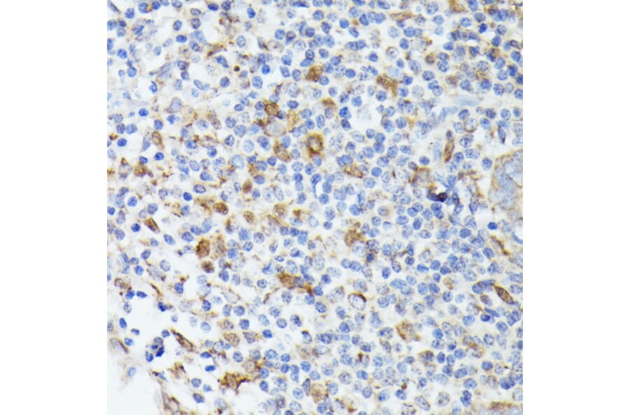 Immunohistochemistry - Anti-TIAL1 Antibody (A9790) - Antibodies.com