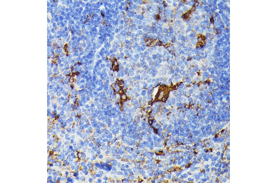 Immunohistochemistry - Anti-TIAL1 Antibody (A9790) - Antibodies.com