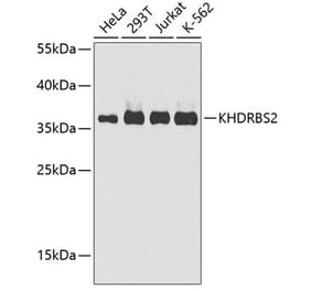 Western Blot - Anti-SLM-1 Antibody (A9793) - Antibodies.com