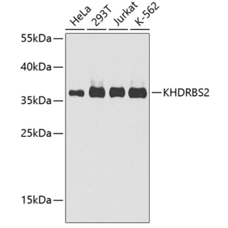 Western Blot - Anti-SLM-1 Antibody (A9793) - Antibodies.com