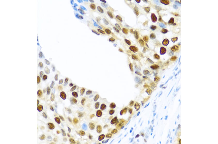 Immunohistochemistry - Anti-SLM-1 Antibody (A9793) - Antibodies.com