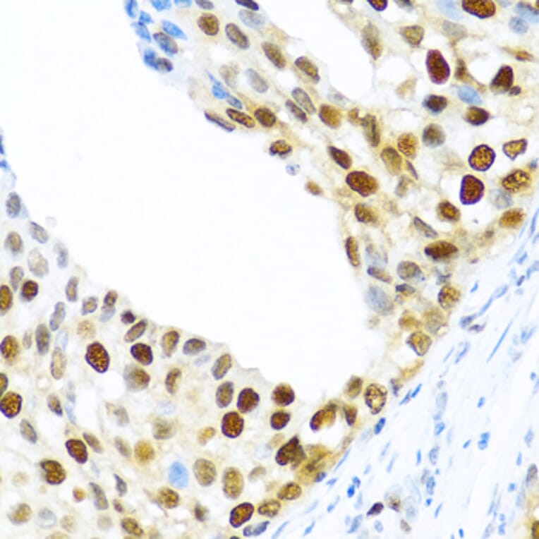 Immunohistochemistry - Anti-SLM-1 Antibody (A9793) - Antibodies.com