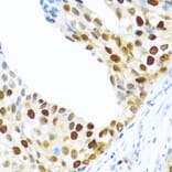 Immunohistochemistry - Anti-SLM-1 Antibody (A9793) - Antibodies.com