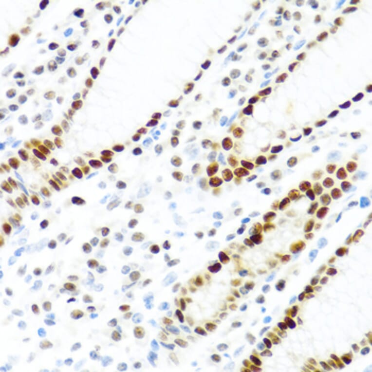 Immunohistochemistry - Anti-SLM-1 Antibody (A9793) - Antibodies.com