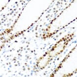 Immunohistochemistry - Anti-SLM-1 Antibody (A9793) - Antibodies.com