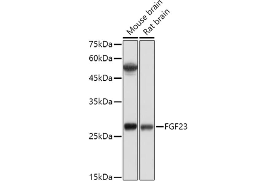 Western Blot - Anti-FGF 23 Antibody (A9796) - Antibodies.com
