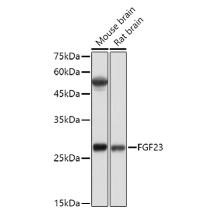 Western Blot - Anti-FGF 23 Antibody (A9796) - Antibodies.com
