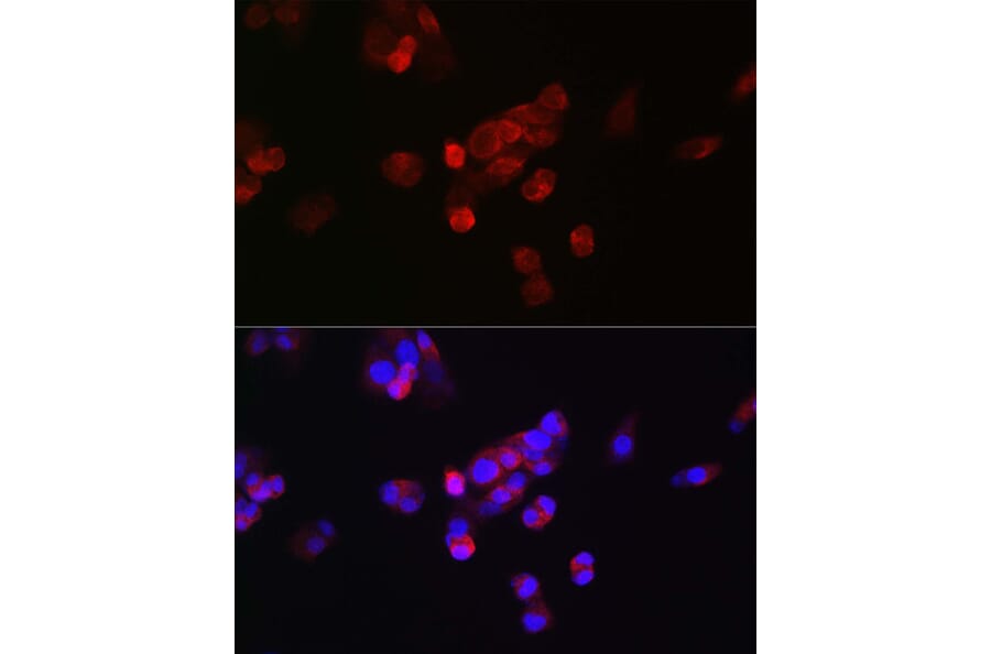 Immunofluorescence - Anti-FGF 23 Antibody (A9796) - Antibodies.com