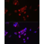 Immunofluorescence - Anti-FGF 23 Antibody (A9796) - Antibodies.com