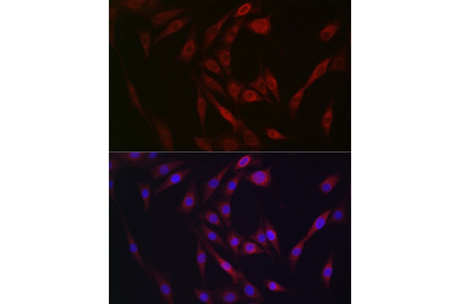 Immunofluorescence - Anti-FGF 23 Antibody (A9796) - Antibodies.com